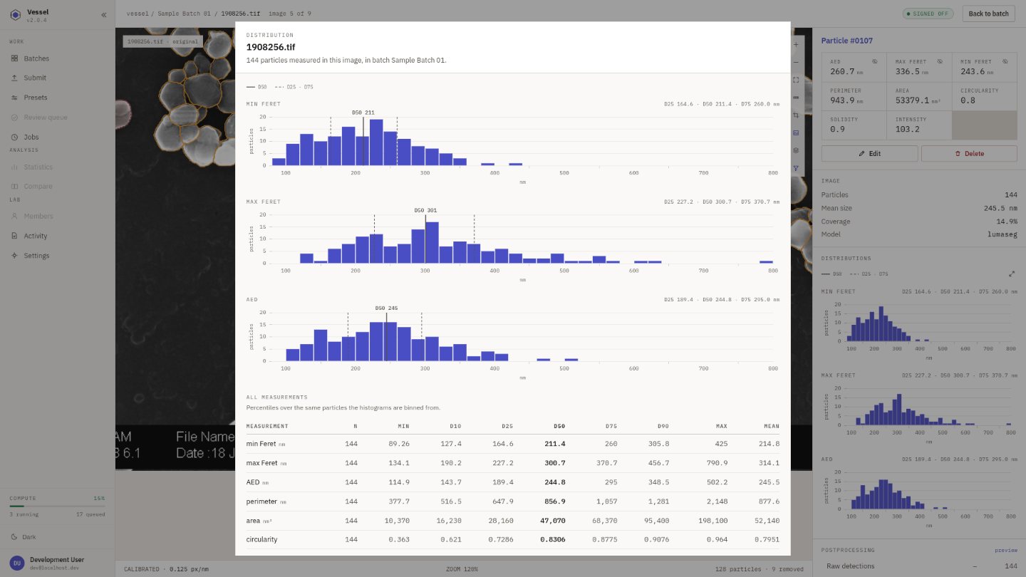 Vessel: size distributions with quartiles marked, over a percentile table for the batch.