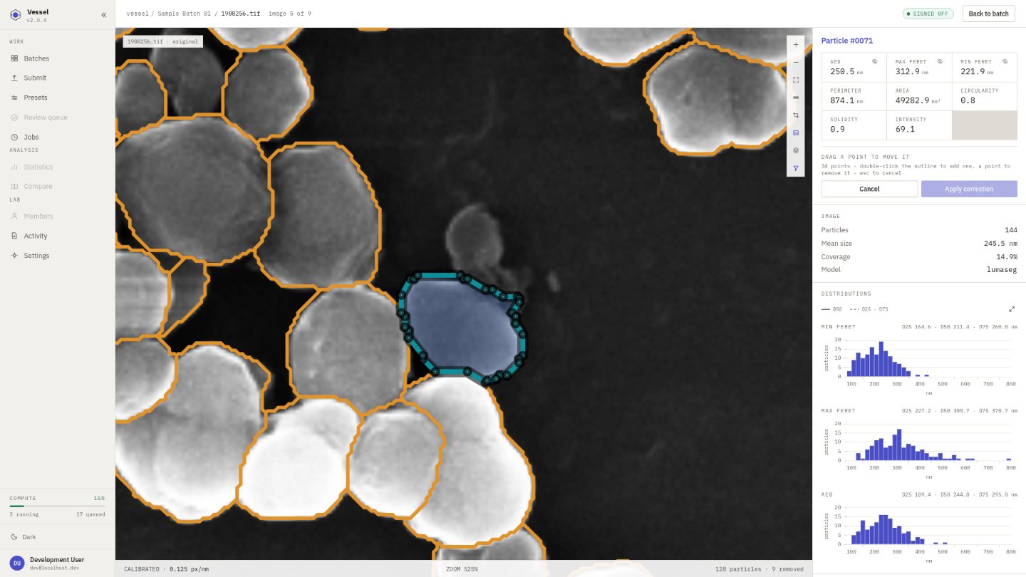 Vessel: a particle boundary under manual correction, its outline broken into draggable points.