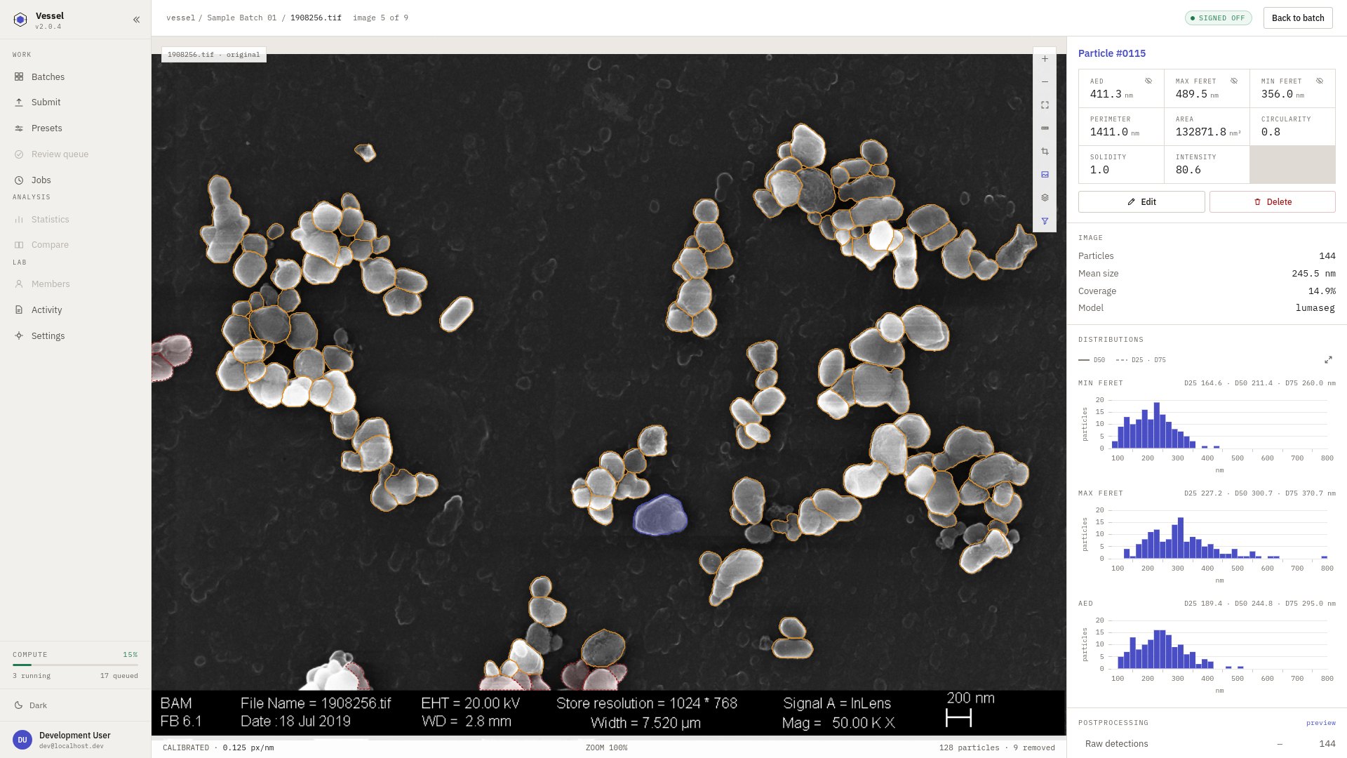 The Vessel workbench: a micrograph with every particle outlined and one selected, its measurements beside it.