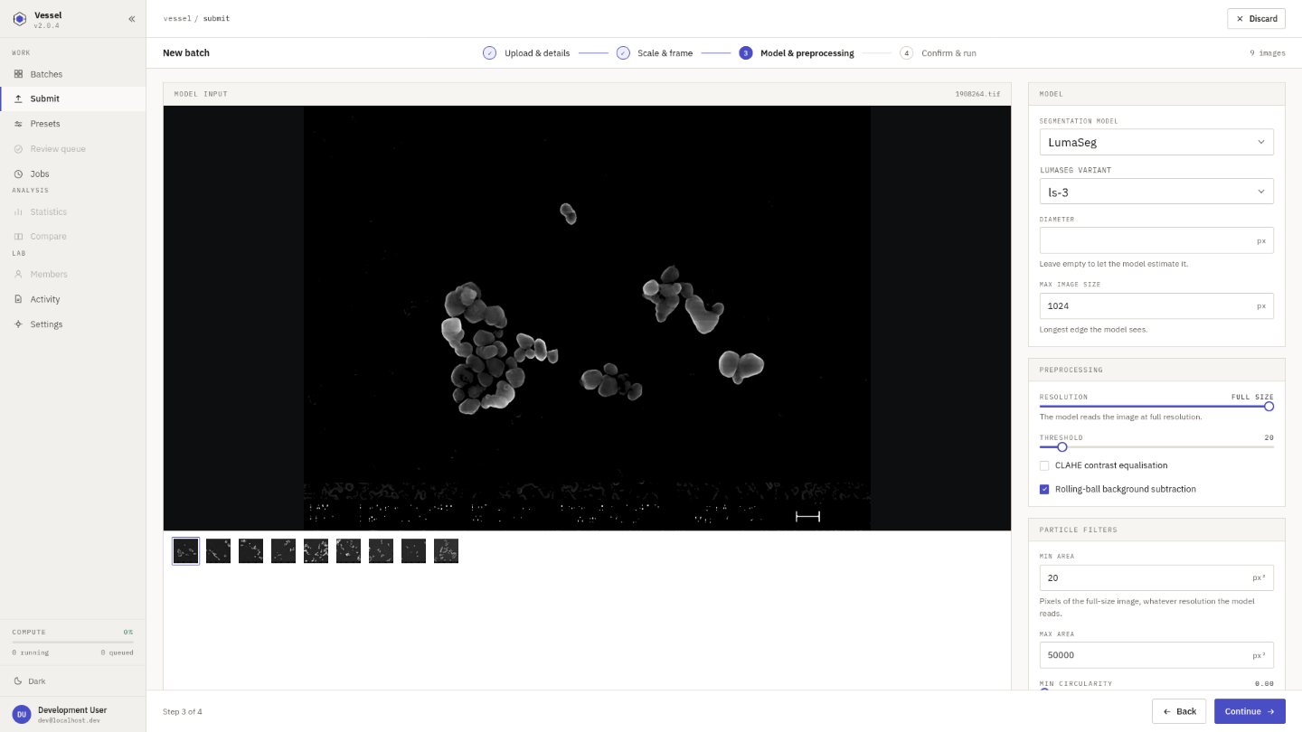 Vessel: segmentation model and preprocessing settings beside a live preview of the image as the pipeline reads it.